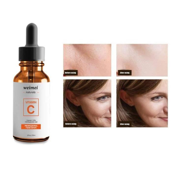 Sérum De Vitamine C Pour Le Visage 1 Oz.