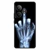 For Realme GT 6T Case Silicone Soft Lions Cat TPU Back Cover For Realme GT Neo6 Cases Protective GT6t 5G Fashion Lovely Shell