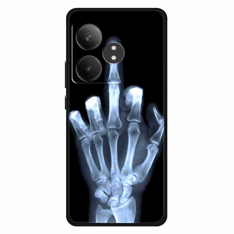 For Realme GT 6T Case Silicone Soft Lions Cat TPU Back Cover For Realme GT Neo6 Cases Protective GT6t 5G Fashion Lovely Shell