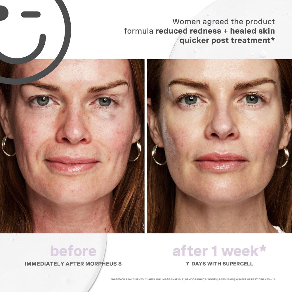 Kate Somerville Kateceuticals Supercell Rejuvenation Serum 1.0 Oz