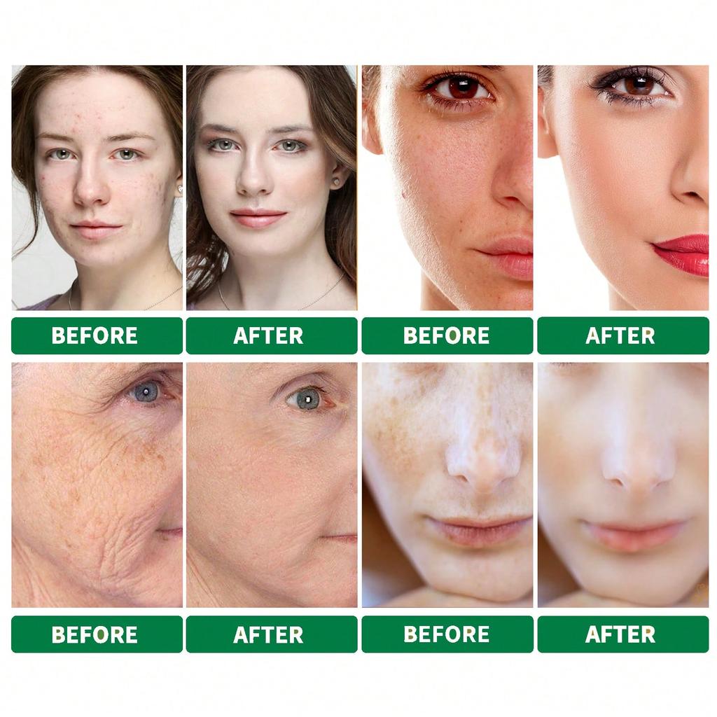 Dunkle Flecken Korrektur Aufhellendes Serum Für Strahlende Haut Gleichmäßiger Teint Aufhellen Hyperpigmentierung