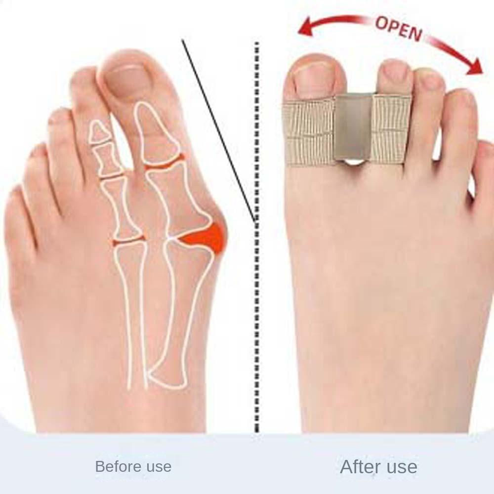 Pedicure Tool Toe Straightener SEBS Toe Valgus Corrector Comfortable Toe Separators  Travel