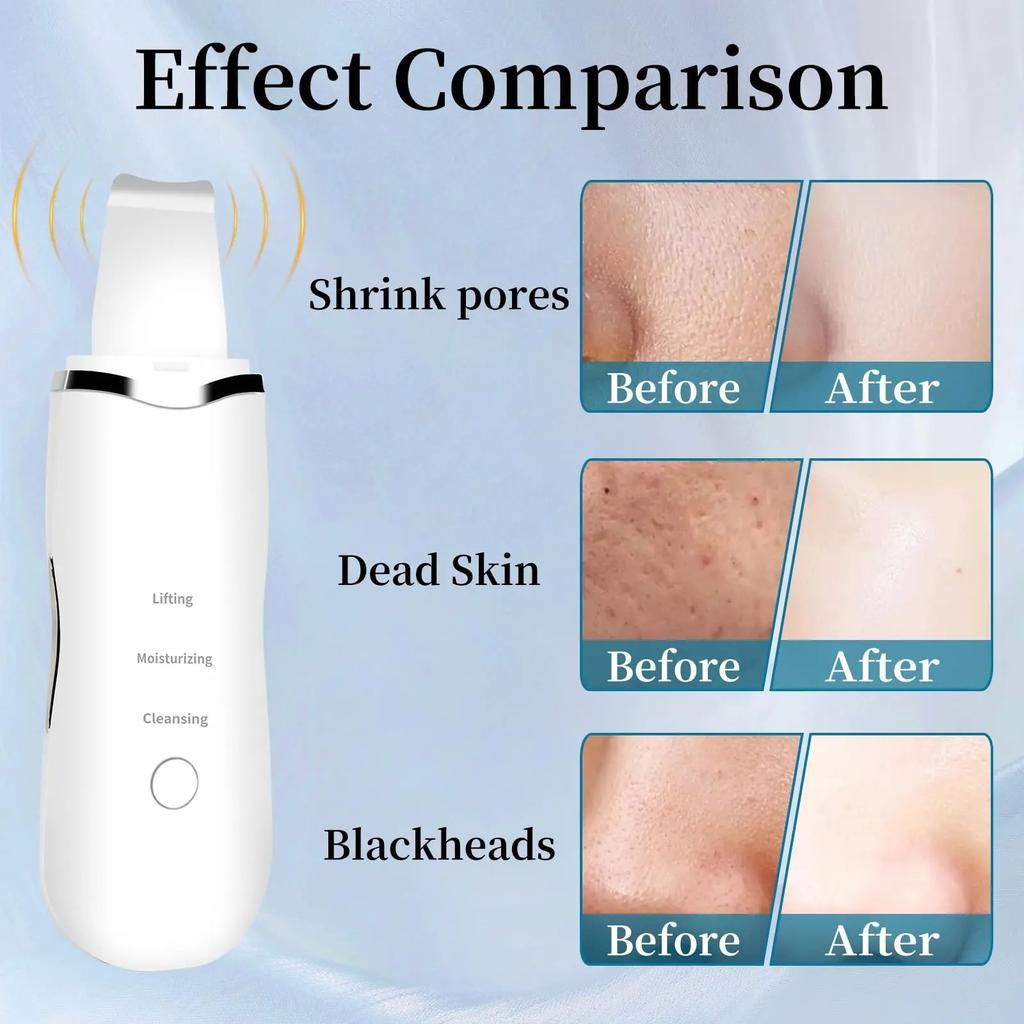 Deep Vibrate Ultrasonic Skin Scrubber Scrubber Deep Vibrate Facial Cleaner Shovel Face Scrubber Peeling Black Head Remover Facial Massager