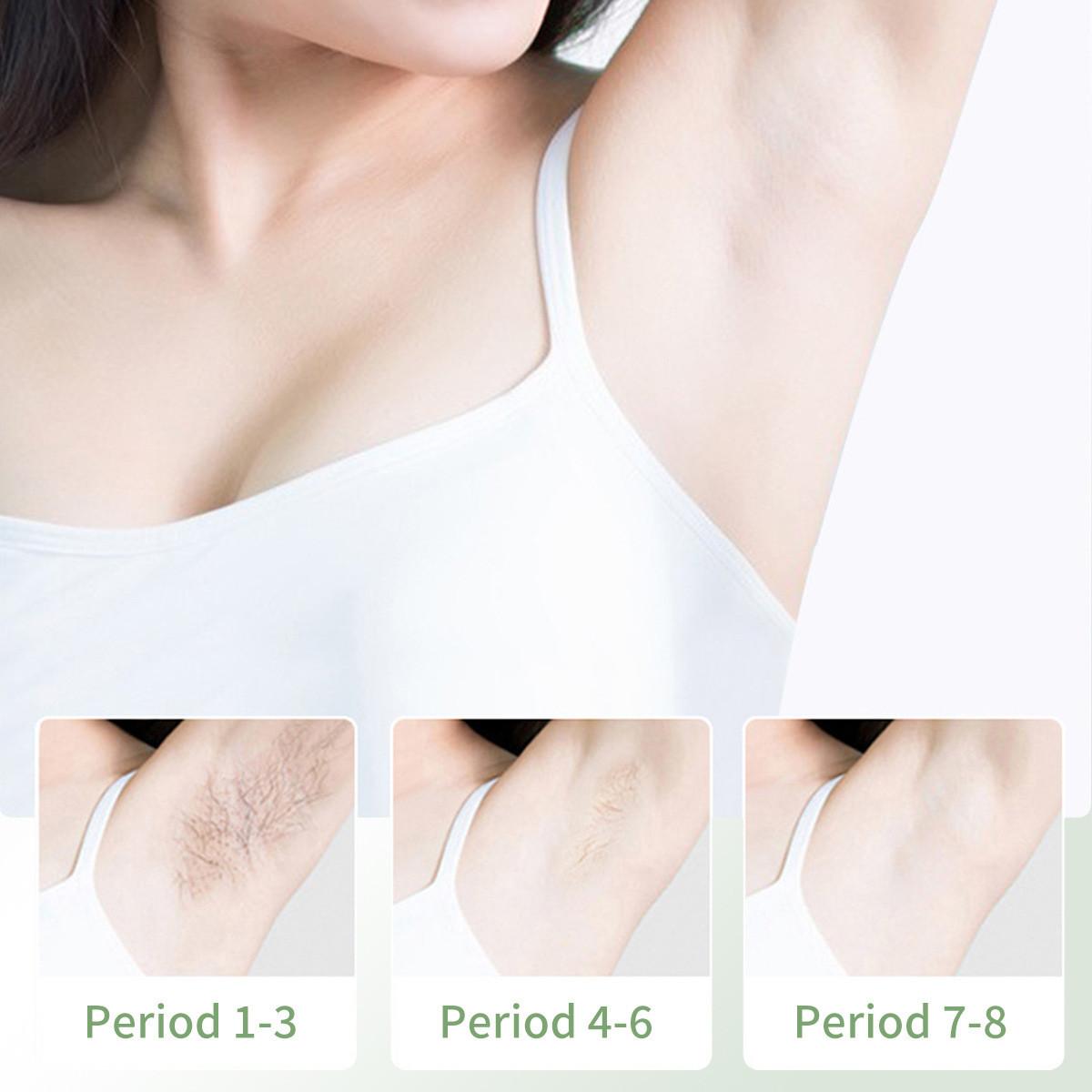 Крем для удаления волос на чувствительной коже для женщин Удаление волос на бикини — фото 3