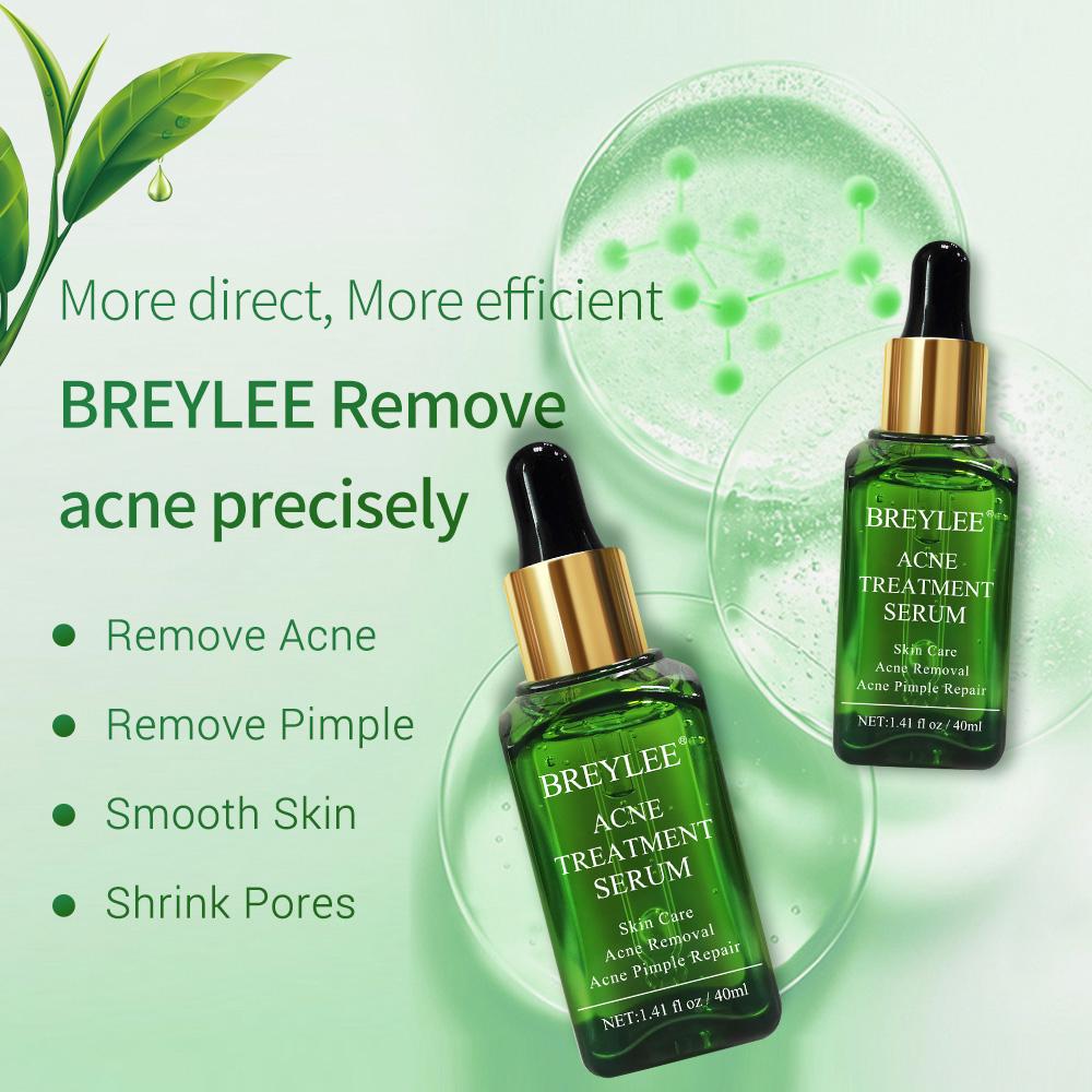 skin care acne remove