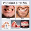 Silicone Denture Set Silicone Material Comfortable Perfect Fit Mouth Cavity No Contain Harmful Substances Not Easily Worn
