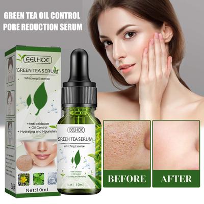 Grüntee-Serum, 10 ml, Gesichtsbehandlung, Ölkontrolle, Porenverkleinerung, Gesichtsserum, Entfernung dunkler Flecken, Verbesserung von Akne, Mitessern, Hautpflege