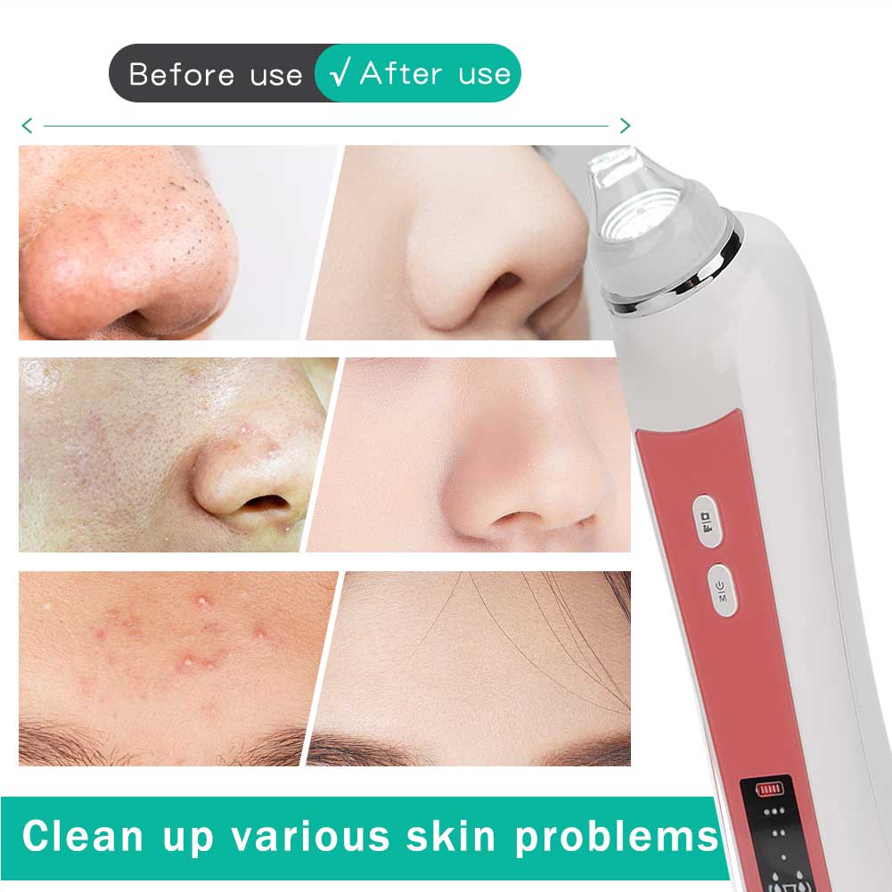 Electric Facial Blackhead Cleansing Vacuum Suction Machine with 20X 5MP Visual Function