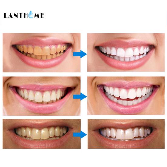 Teeth Whitening Essence