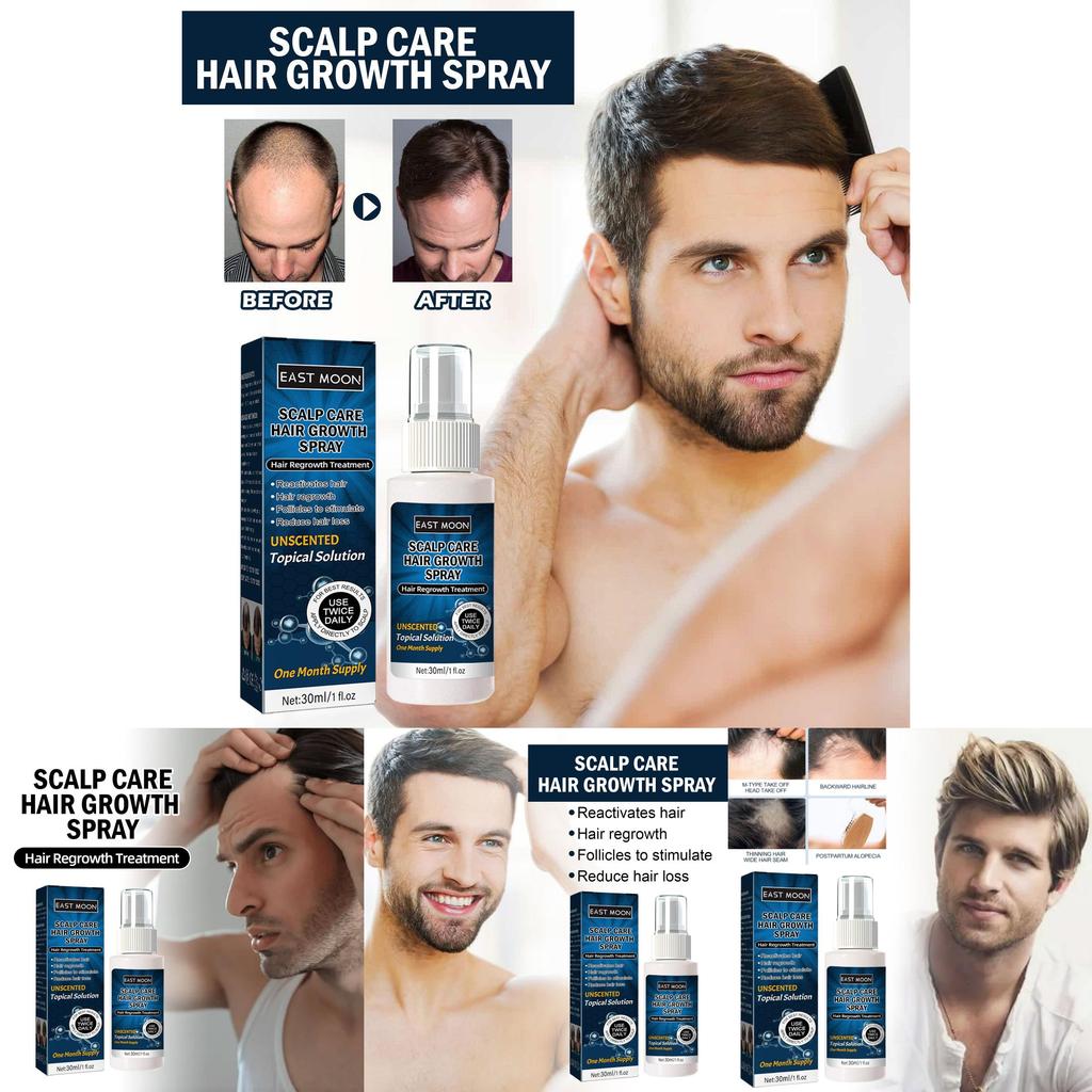 East Moon Men's Hair Growth Spray For Thicker Hairline And Prevents Hair Loss
