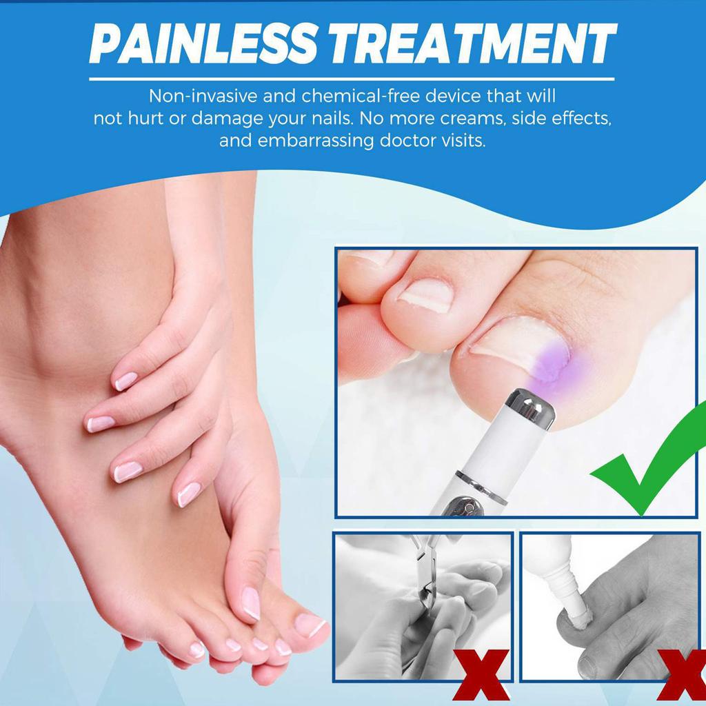 Tužka s modrým světlem na nehty, Šedá tužka na nehty, Snadné použití, Odstraňovač zápachu, Péče o nehty