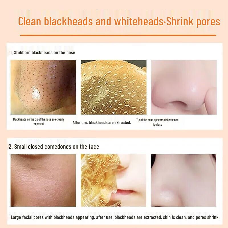 Tong Ren Tang Deep Cleansing Blackhead & Pore Refining Masks