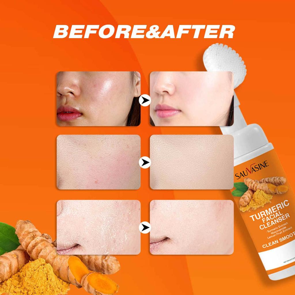 SAUVASINE Turmeric Facial Cleanser for Deep Cleansing, Oil Control, and Acne Removal
