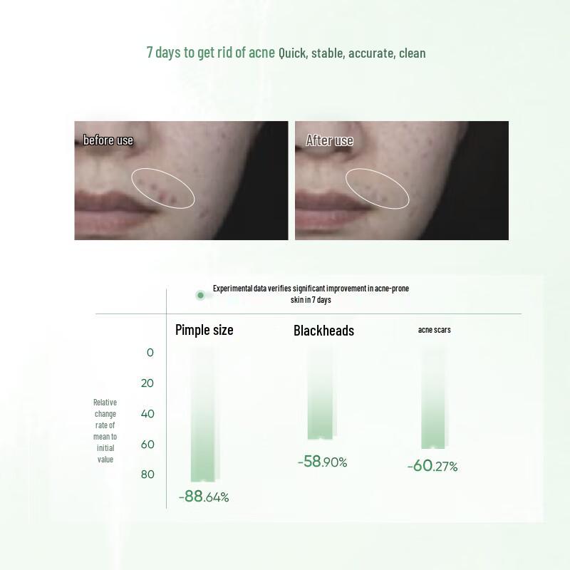 Kans Oil Control Acne Treatment Essence Water 100ml