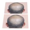 Man Bald Micropigmentattion Practice Skin Silicone Hairline Microblading Practice Pads for Scalp Pra