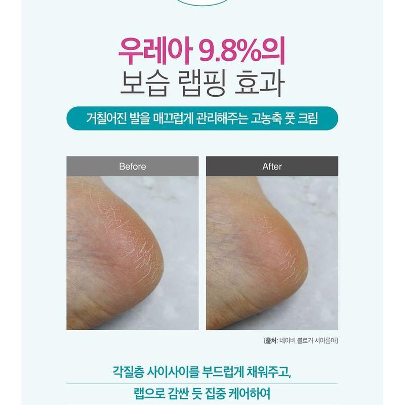 Derma: B - Urea Foot Cream