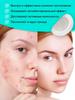 Acne treatment patches blemish control pimple patches set hydrocolloid acne remedy stickers for face spot healing clear skin care solution