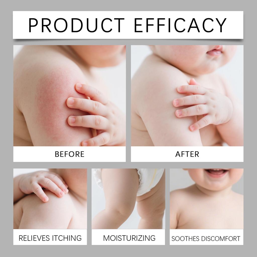 Skin Soothing Patch Soothing Patch Soothing Patch Itching Mild And Suitable For Infants And Young Children.