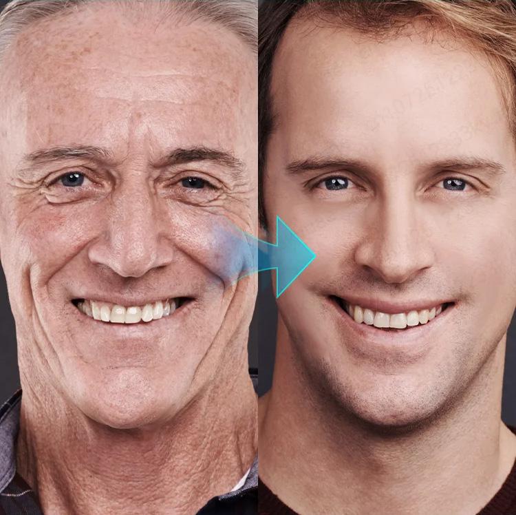 Moisturizing Hyaluronic Acid Nourishing Moisturizing Cream, Gentle and Non-irritating, Hydrating and Moisturizing, Nourishing the Skin