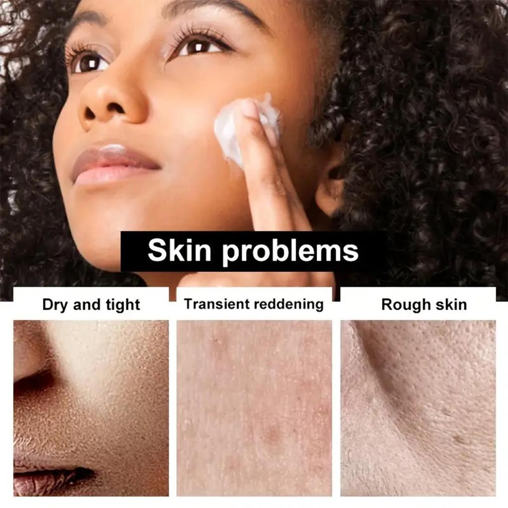 Moisturizing Face Cream, Repair Dry Skin, Make Skin Delicate And Tender, Suitable For All Skin Types, And Make Your Skin Look Younger