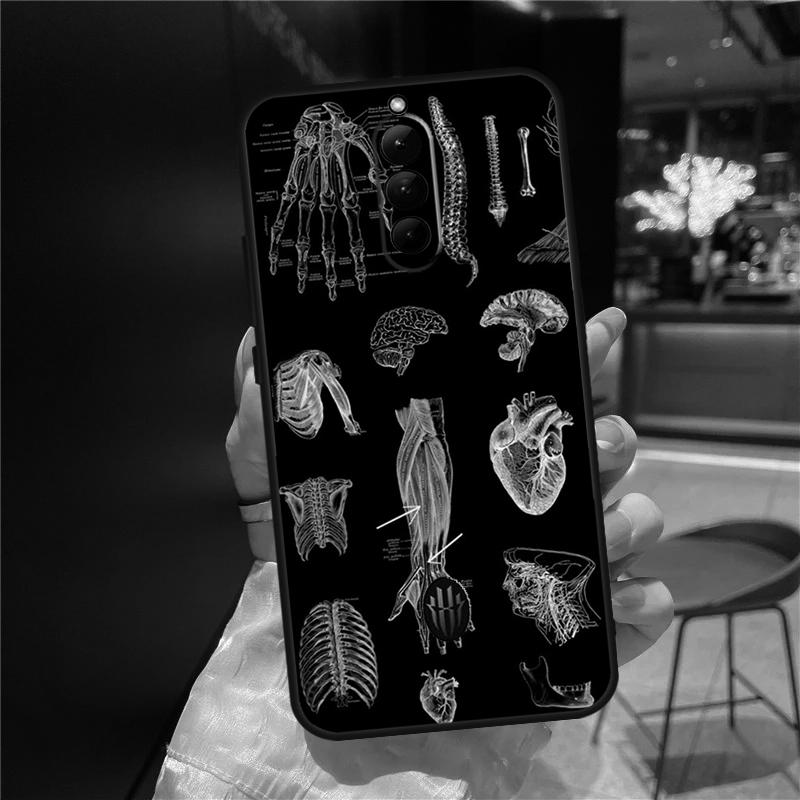 Human Anatomy Case For ZTE Nubia Red Magic 11 10 9 8 8S 9S 10S Pro Plus 6 7 6S 7S For RedMagic 10 Air Cover