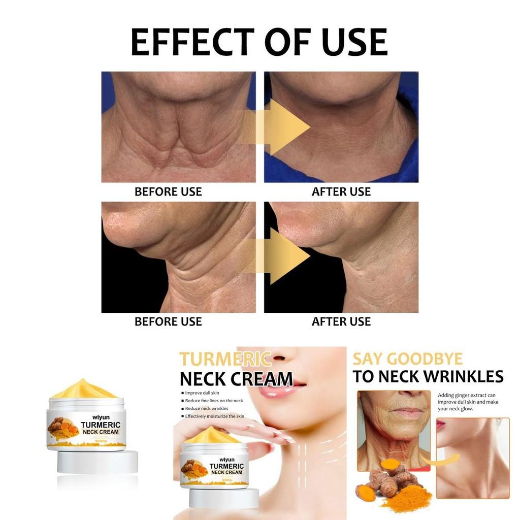 Wiyun Turmeric Neck Firming Cream For Youthful Skin Hydration And Wrinkle Reduction