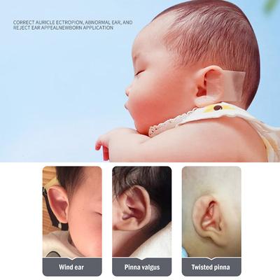 Baby Ear Correctors Medical Silicone Tape Infant Ear Correction Patch