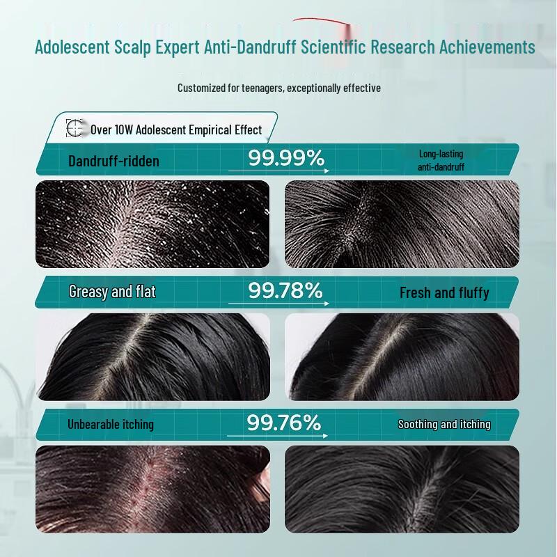 

BAILUHUI Teenager Anti-Dandruff & Oil Control Shampoo