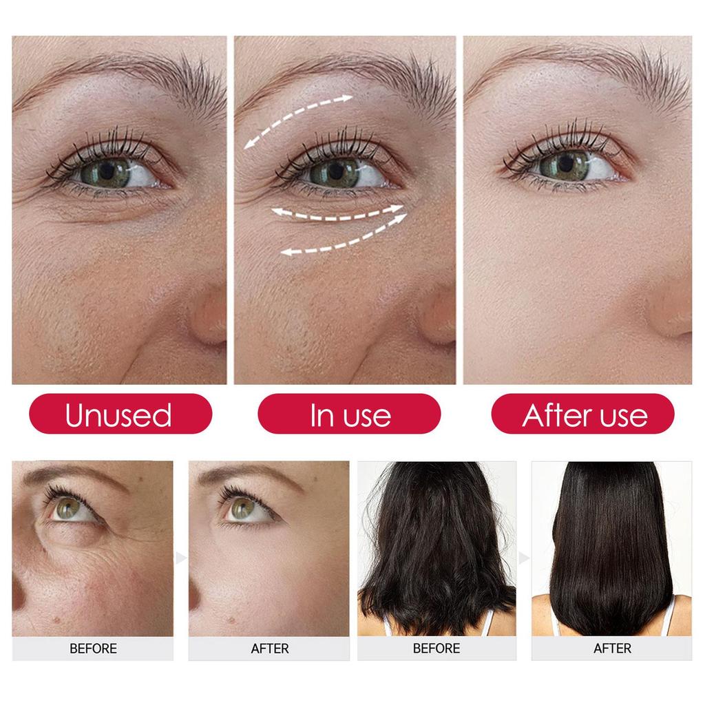 EELHOE Rosehip Oil 30ml: Reduces fine lines, brightens and whitens, fades dark spots, deeply moisturizes, and softens hair. A skin and hair care oil.