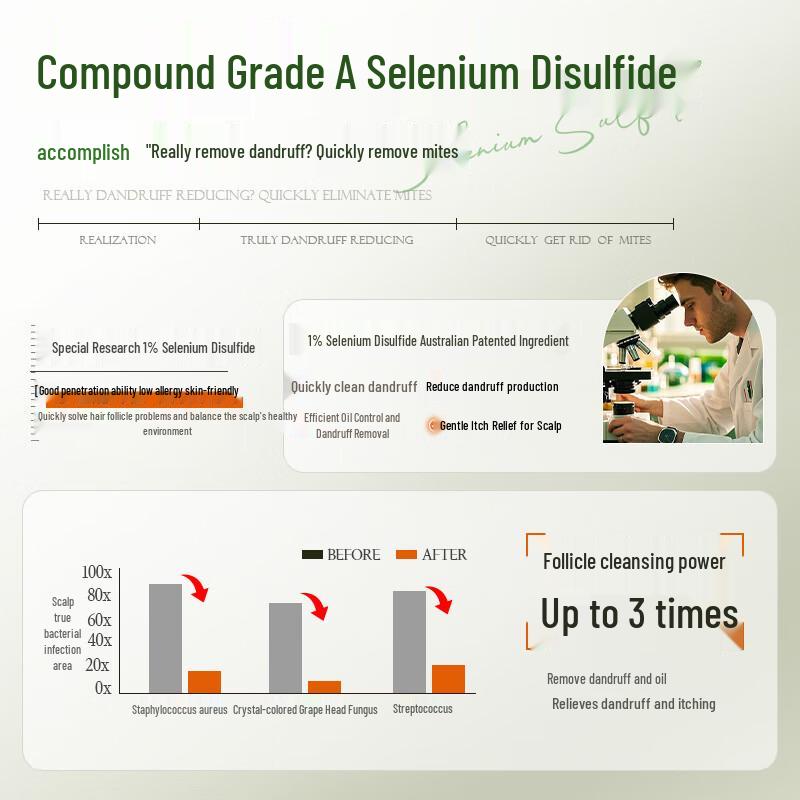 Layanana 1% Selenium Disulfide Anti-Dandruff Shampoo