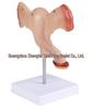 Female Pathology Uterus Model for Obstetrics & Gynecology Education