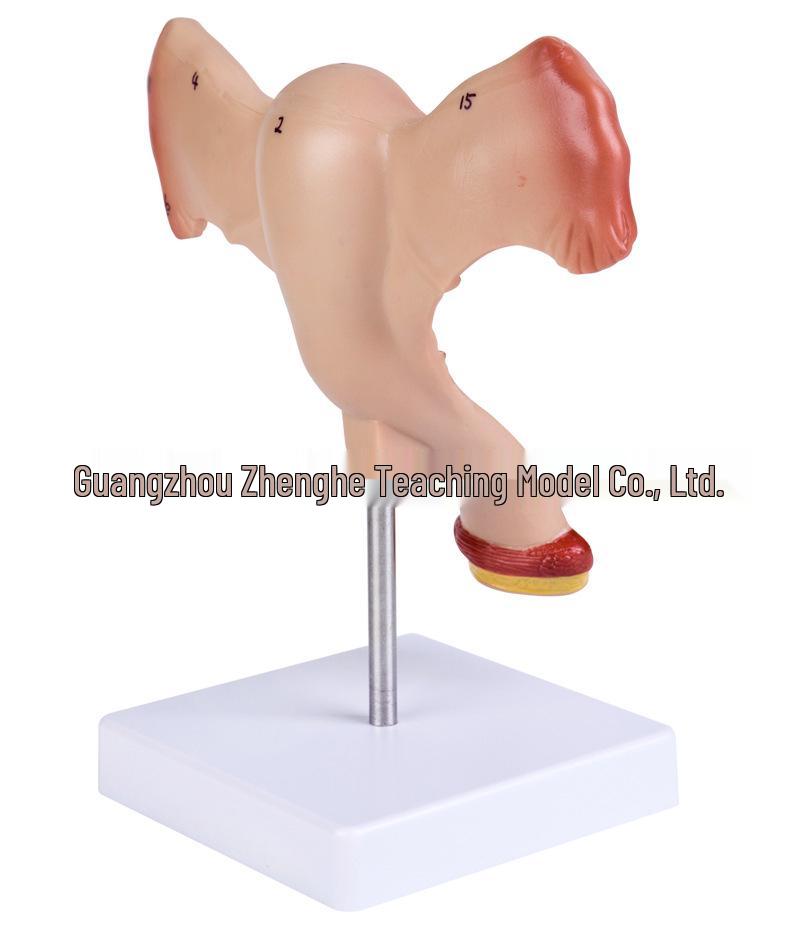Female Pathology Uterus Model for Obstetrics & Gynecology Education