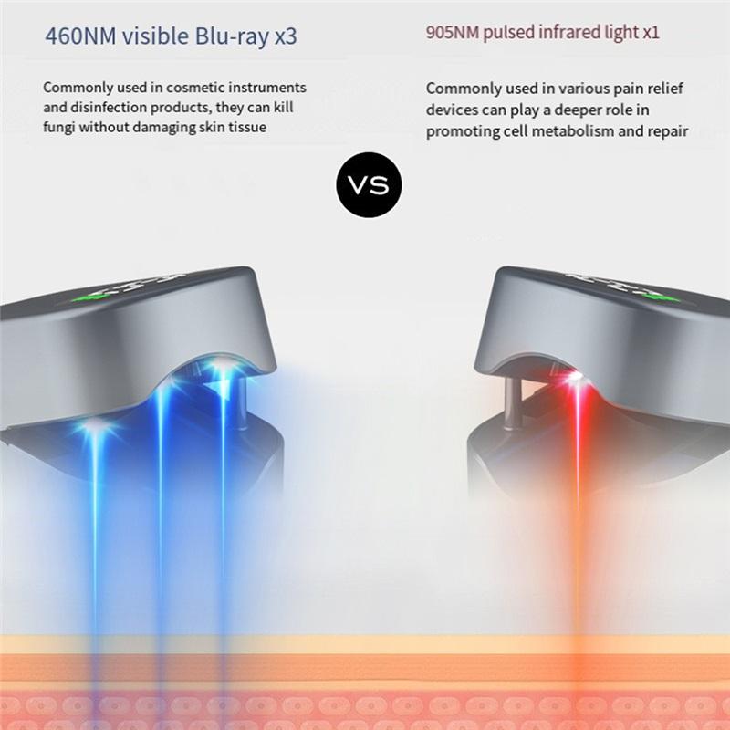 Nagelpilz-Lichtgerät Nagelpilz-Reinigungsgerät Tragbar 460nm Blaulicht 905nm Infrarotlicht für Nagelpilzinfektionen