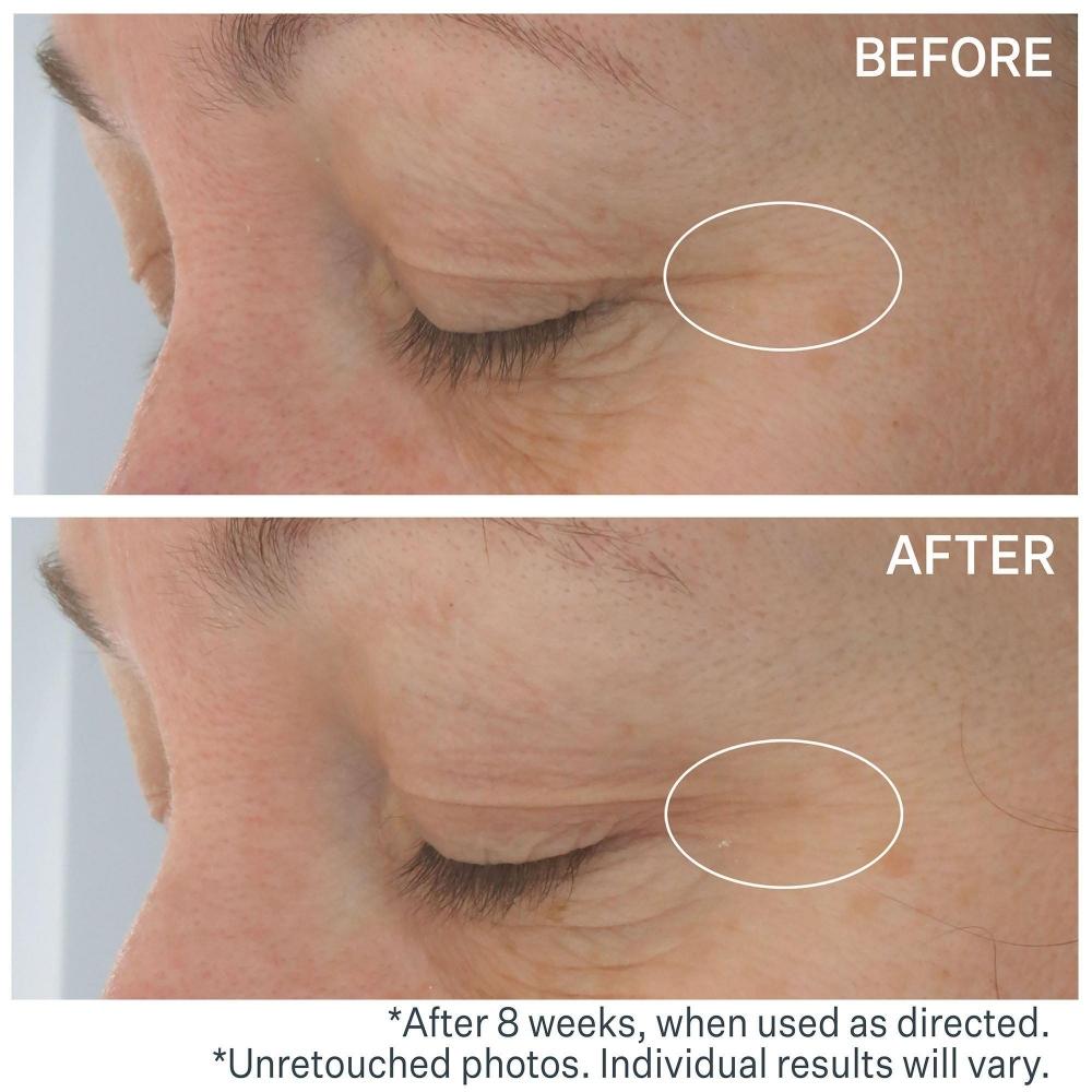 Strivectin Hyaluronic Tripeptide Gel Cream For Eyes 0.5 Oz