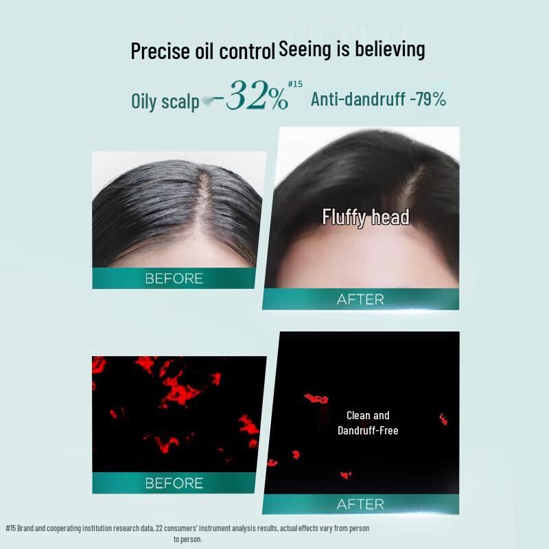 L'Oréal Salicylic Acid Scalp Oil Control Anti-Dandruff Shampoo 440ml