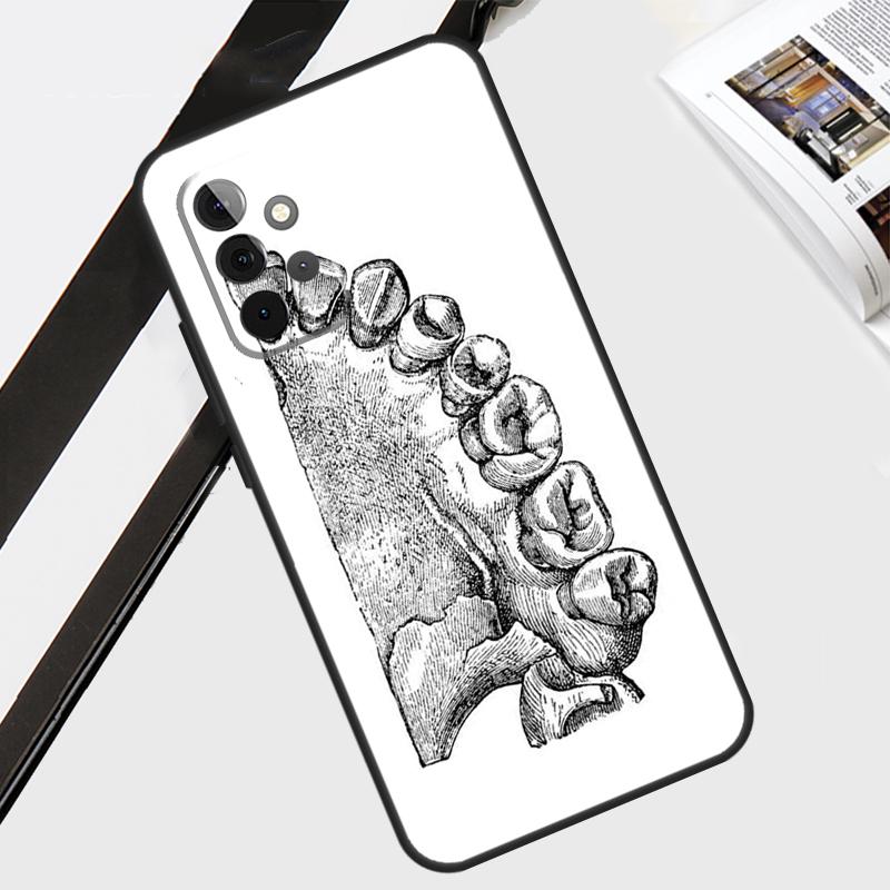 Zahnarzt Zahnmuster Hülle Für Samsung Galaxy A34 A54 A14 A52 A32 A12 A22 A72 A42 A13 A33 A53 A51 A71 Abdeckung