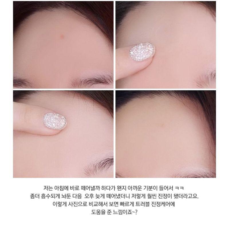 RiRe - Red Spot Micro Needle Patch