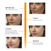 BREYLEE - Anti-Aging Vitamin C and Vitamin E Serum for the Face, Anti-Aging, Whitening, Essence, Topical Oil, Hyaluronic Acid, Cosmetic, 17ml