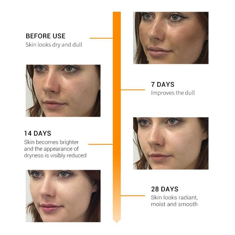 BREYLEE - Anti-Aging Vitamin C and Vitamin E Serum for the Face, Anti-Aging, Whitening, Essence, Topical Oil, Hyaluronic Acid, Cosmetic, 17ml