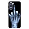 For ZTE Nubia S 5G A403ZT Case Soft Black Silicone Back Cover For Nubia S 5G Protective Shockproof TPU Funda  A403ZT Phone Cases