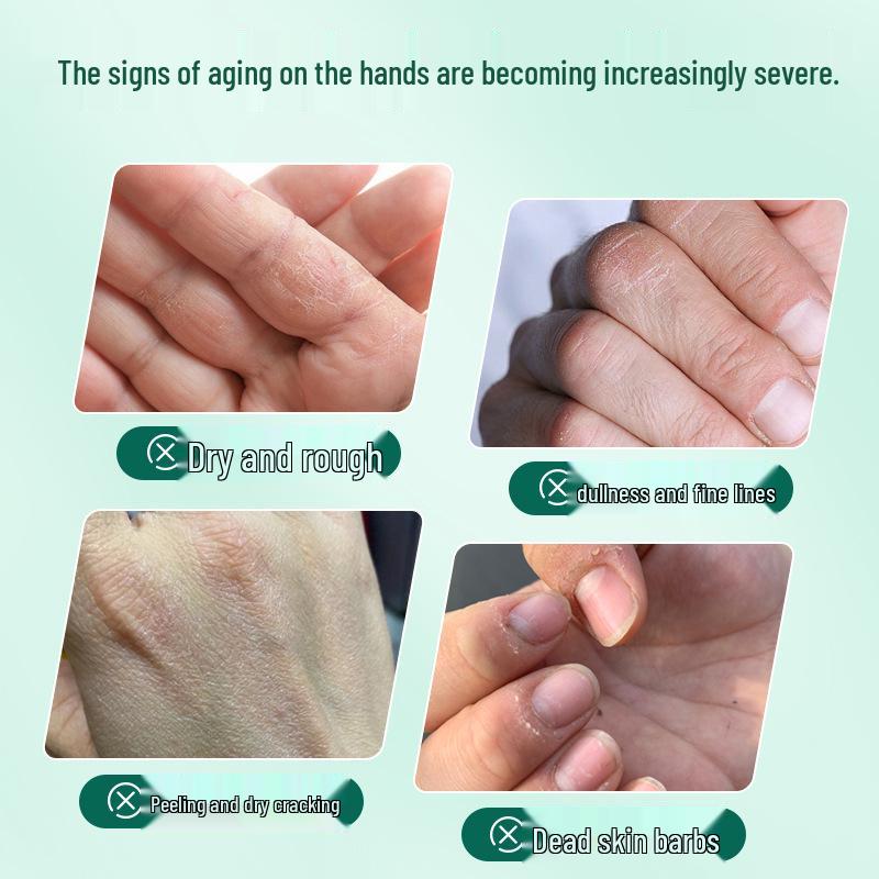 Tuoneng Medical Hand Cream: Polyethylene Glycol Moisturizing & Repairing Solution for Dry, Cracked, and Peeling Skin. Suitable for Both Men & Women.