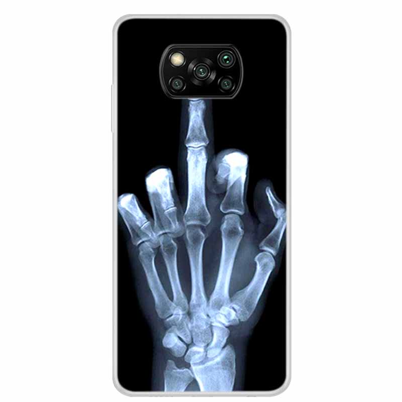 For Poco X3 Pro Case X3 NFC 6.67" Clear Marble Soft TPU Silicone Back Case for Xiaomi Poco X3 NFC Phone Covers Shockproof Fundas