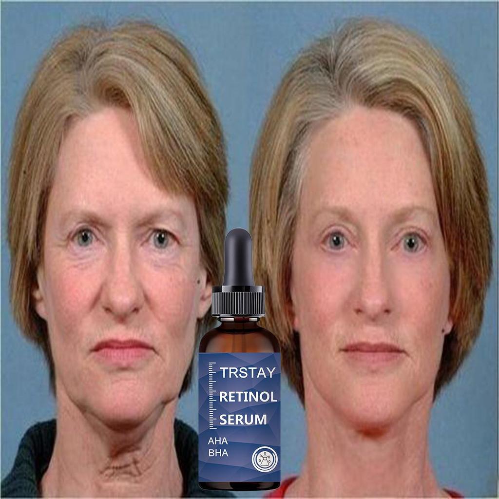 Skincare Product 24K Gold Niacinamide Face Serum Anti Aging Hyaluronic Acid For Face Shrinks Pores Korean Skin Care Products