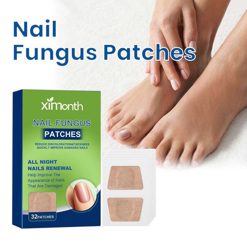 Patchs Réparateurs pour Ongles d'Orteil Ximonth Pour Soin Nourrissant et Adoucissant des Ongles Fongiques