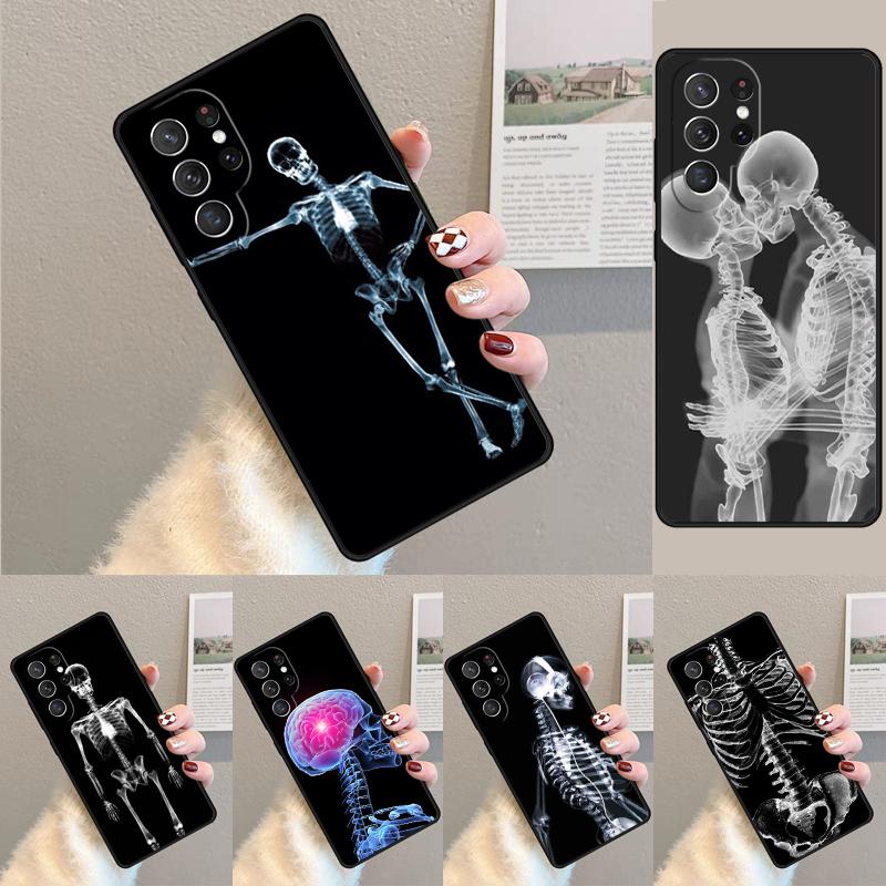 X-Ray Human Anatomy soft TPU Phone Case For Samsung Galaxy note 10 pro S26 S25 S24 S23 S22 Ultra Plus S21 FE S20 Cover