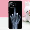 Skeleton Middle Finger Case For Xiaomi 15T 13T 14T 17 Pro Max 15 14 Ultra POCO X7 Pro X5 X6 F5 F6 F7 F8 Ultra Funda
