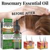 4pcs Rosemary Oil For Hair Growth,rosemary Essential Oil For Hair Growth & Skin Care,improve Hair Loss And Nourishes
