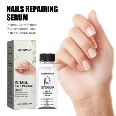 20 ml Nagelreparaturserum, milde natürliche Inhaltsstoffe, stärken, nähren, rissige, brüchige Nägel, intensives Nagelstärkungsserum