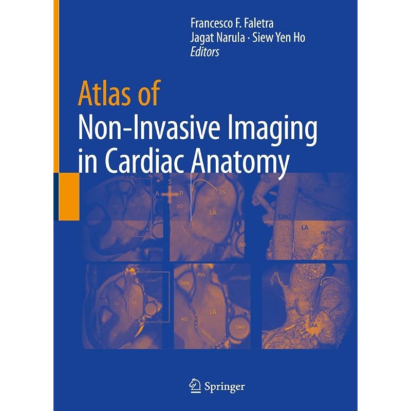 Atlas of NonInvasive Imaging In Cardiac Anatomy