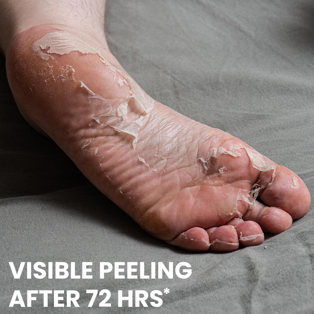 One's Own Made In Korea Foot Peeling Mask, Removes Dead Skin & Hard Calluses, Hydrates Dry & Cracked Feet, Foot Peel Off Mask for Baby Soft Skin (P
